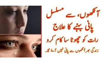 Treatment-to-prevent-watery-eyes