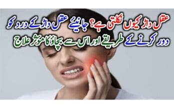 Home-remedies-for-wisdom-teeth-pain-and-inflammation