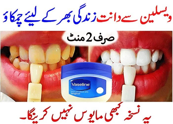 Teeth-Cleaning-Home-Remedy